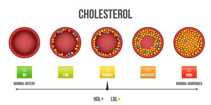 Cholesterol range in blood cells