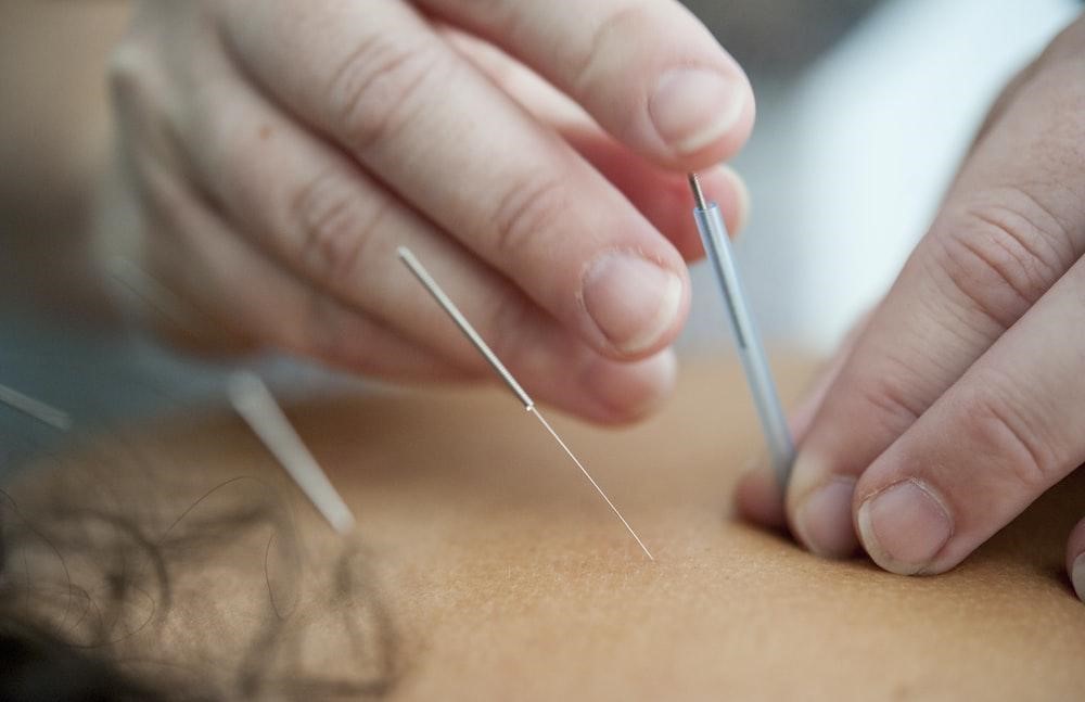 Needle therapy for pain relief